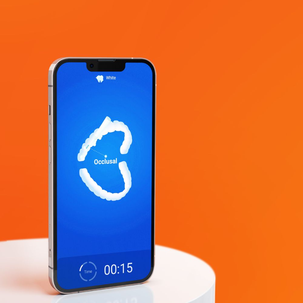 Bitvae S2(3)